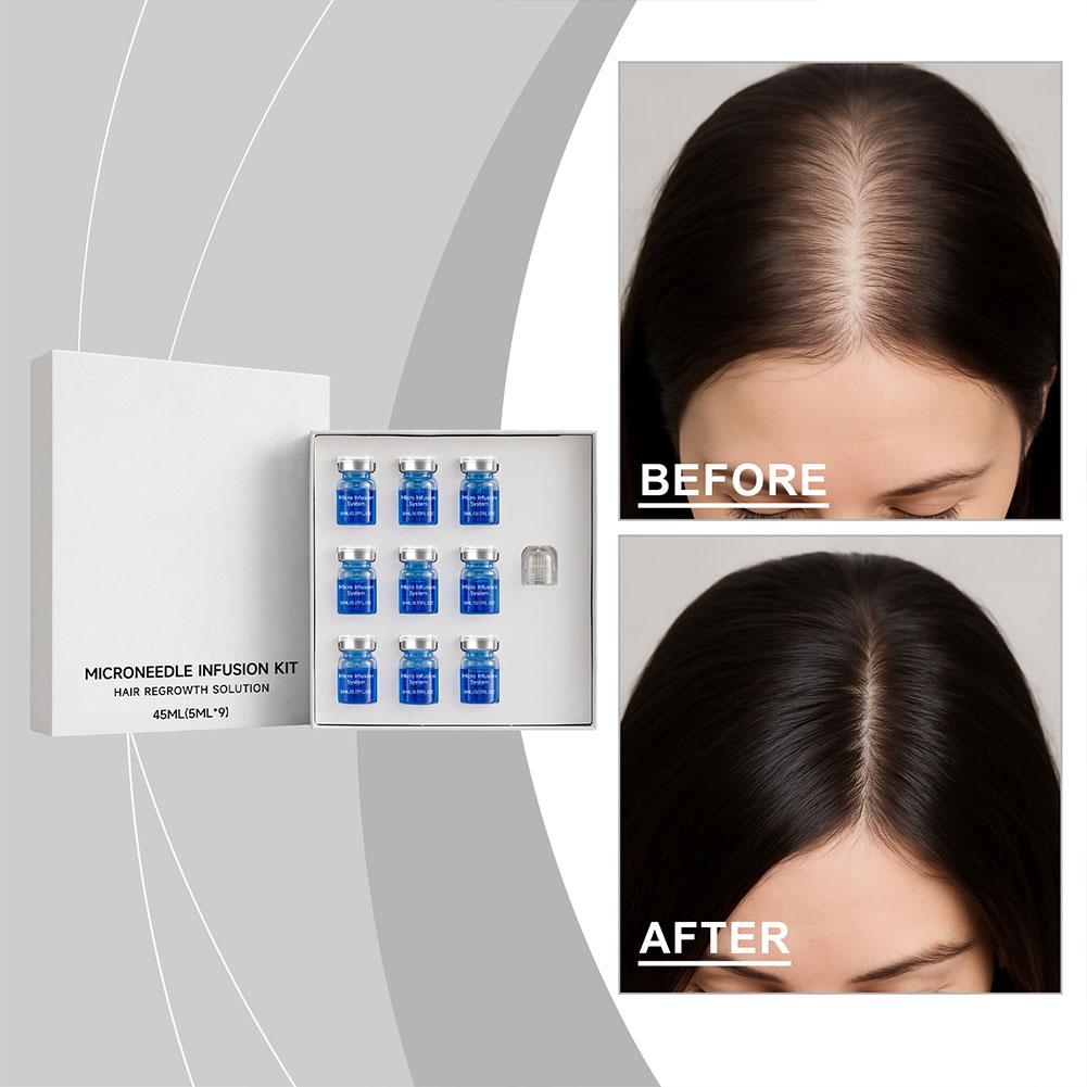 Sérum capillaire essentiel 0,2 - Derma Roller 0.25 avis et prix